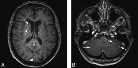 FIG 2.