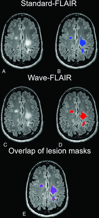 FIG 1.