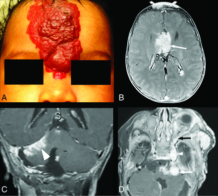 FIG 3.