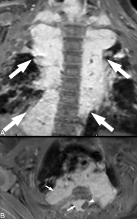FIG 4.