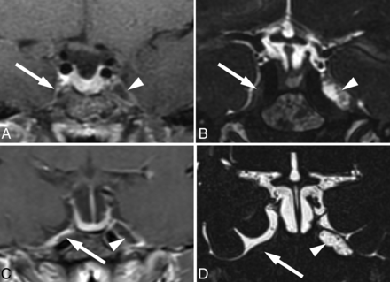 FIG 1.