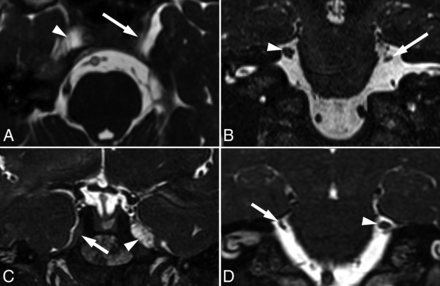 FIG 2.