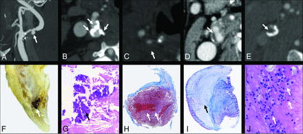 FIG 1.