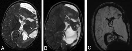 FIG 4.