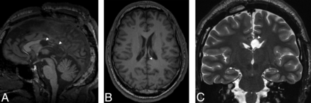 FIG 5.