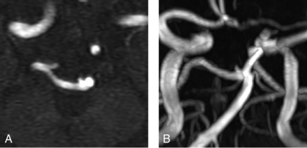 FIG 3.