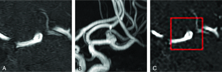 FIG 4.