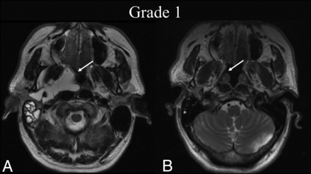 FIG 1.