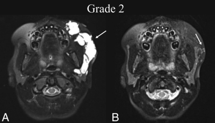 FIG 2.