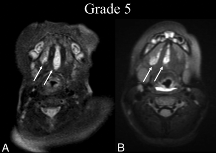 FIG 5.