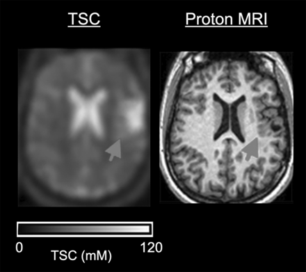 FIG 3.