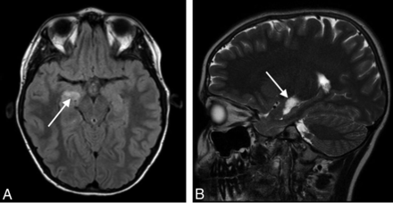 FIG 3.
