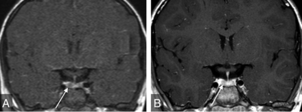 FIG 4.