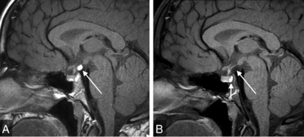 FIG 5.