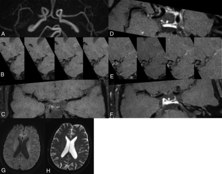 FIG 3.