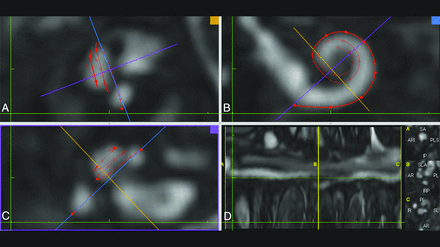 FIG 2.