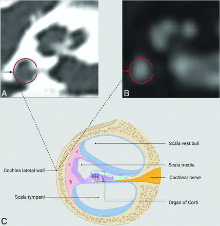 FIG 3.