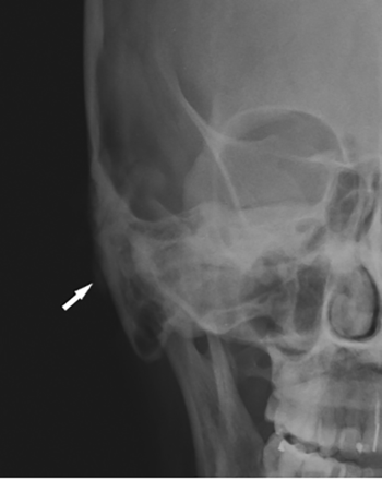 FIG 1.