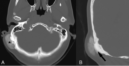 FIG 2.