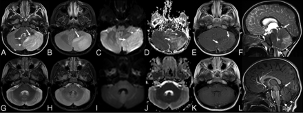 FIG 1.