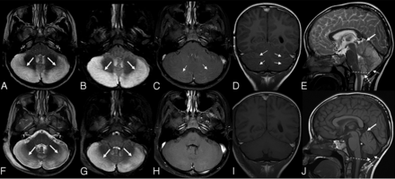 FIG 2.
