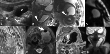FIG 2.