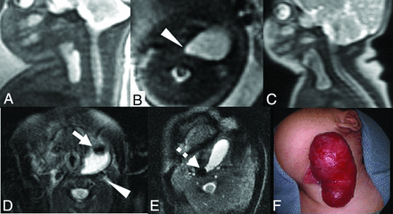 FIG 3.