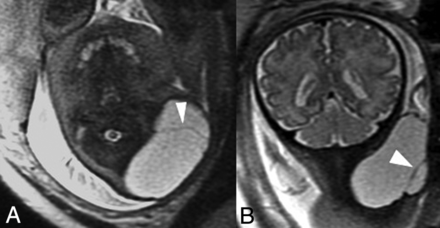 FIG 5.
