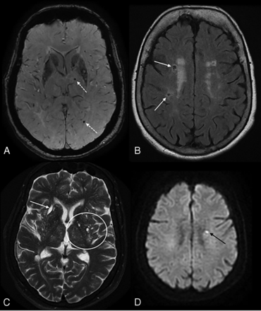 FIG 5.