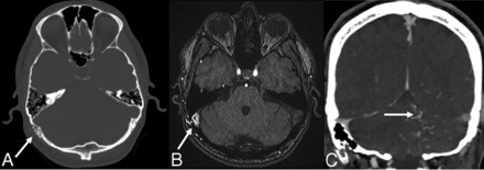 FIG 2.