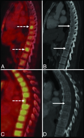 FIG 11.