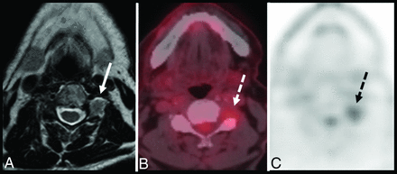FIG 12.