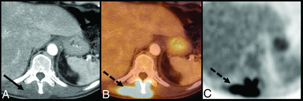 FIG 13.