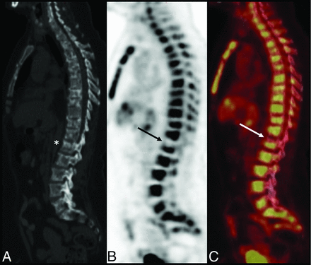 FIG 2.
