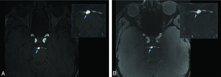 FIG 2.