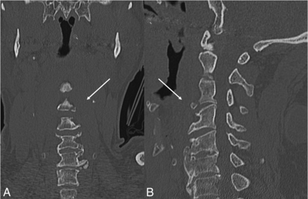 FIG 3.