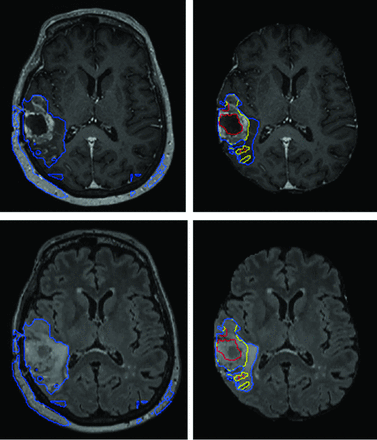 FIG 4.