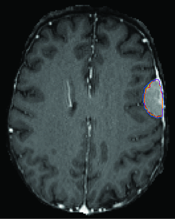 FIG 5.