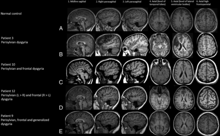 FIG 2.