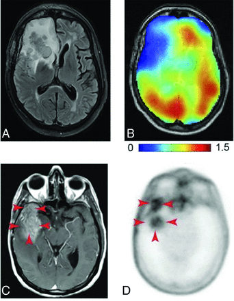 FIG 2.