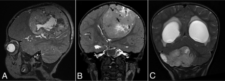 FIG 1.