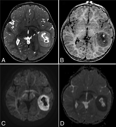 FIG 2.