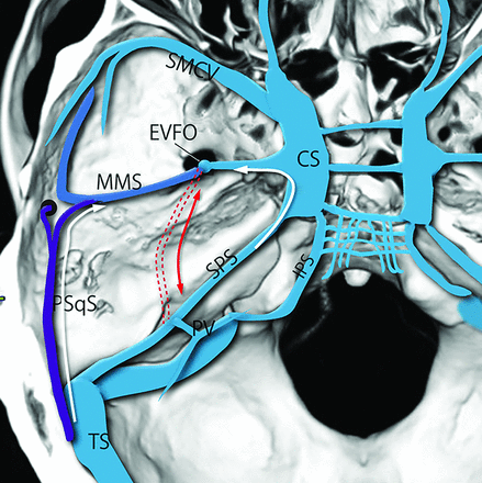 FIG 1.