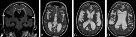FIG 1.