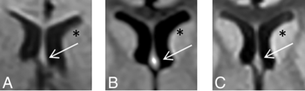 FIG 3.