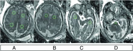 FIG 2.