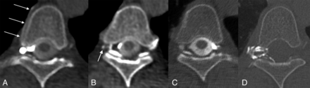 FIG 2.