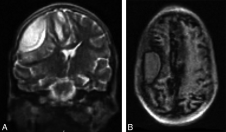 FIG 1.