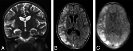FIG 2.