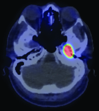 FIG 1.